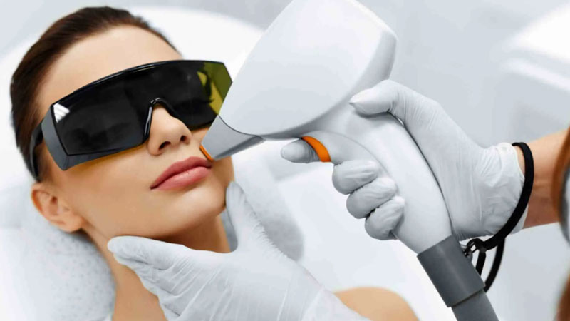 Hair-Laser-Remove;