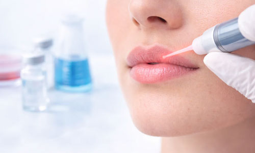 Lip-1